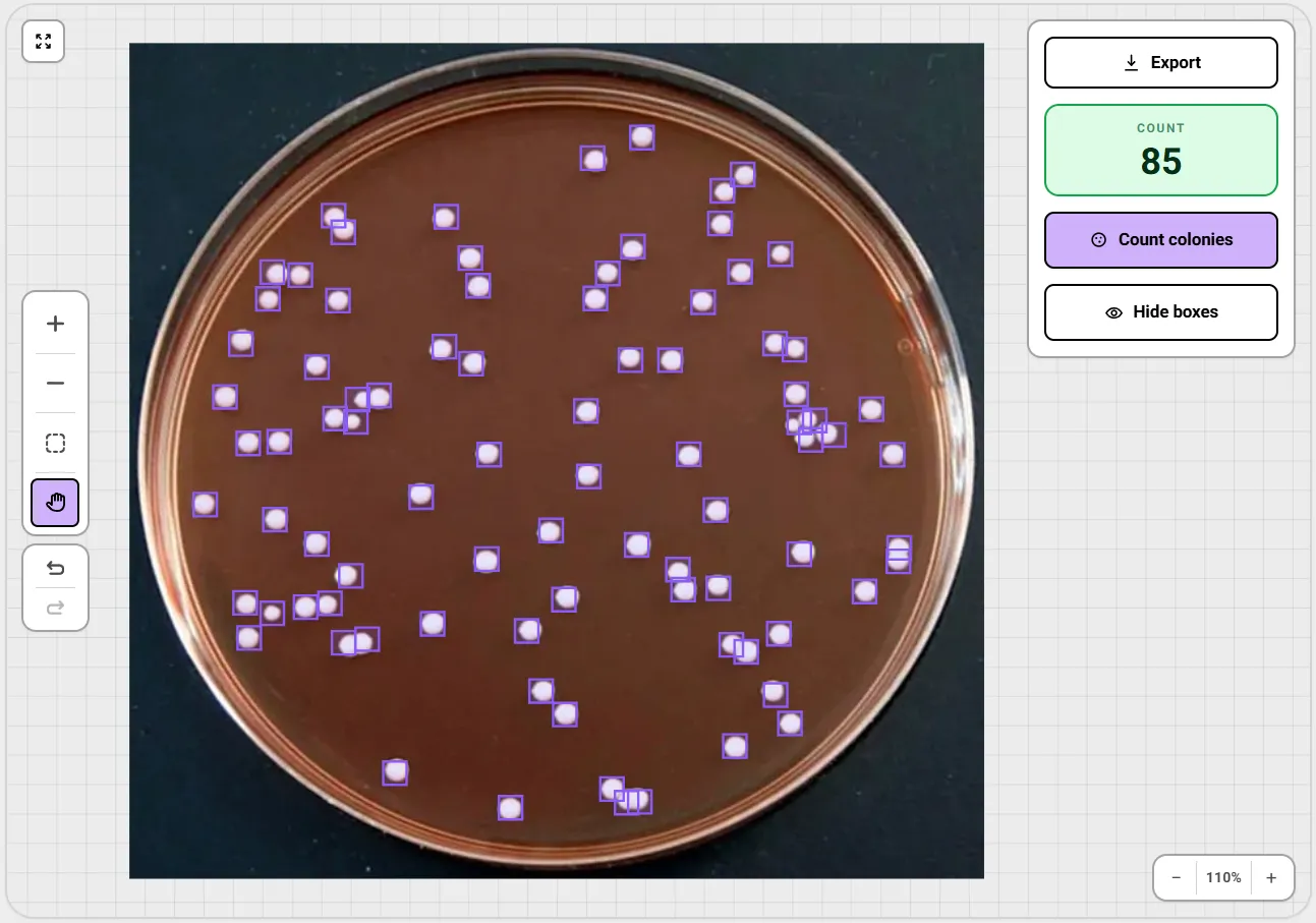Agar plate with bacterial colonies automatically counted by AI in the colony counter tool